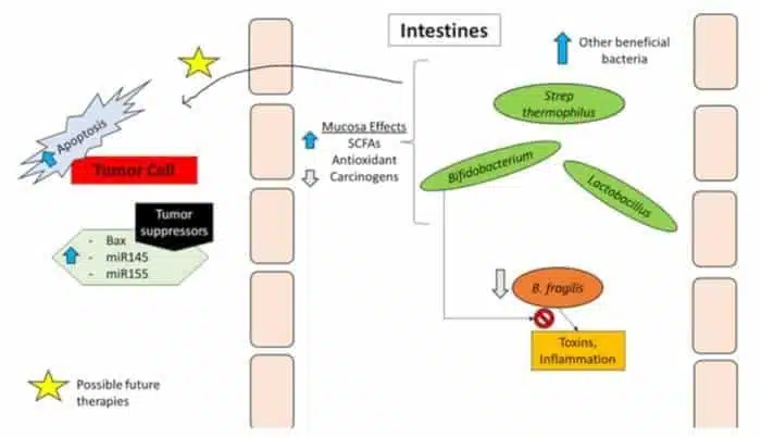 How Probiotics work- kefir effect on cancer