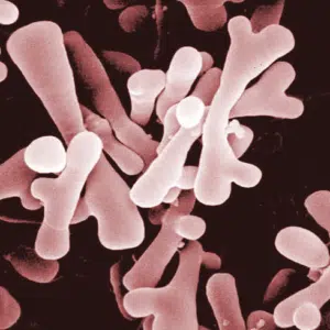 Bifidobacterium Kefirwala 